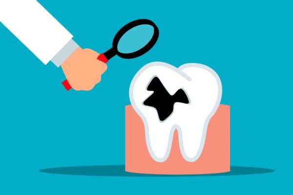 dental-trauma-Cecil Park